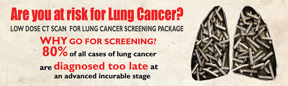 Lung Cancer Screening