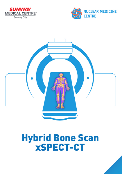 混合骨扫描 xSPECT-CT