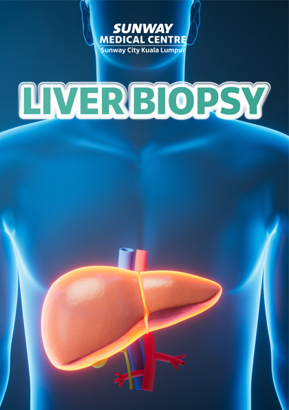 Liver Biopsy