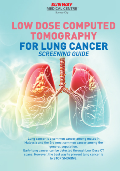 Low dose CT lung cancer screening guide