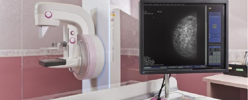 Digital Mammography