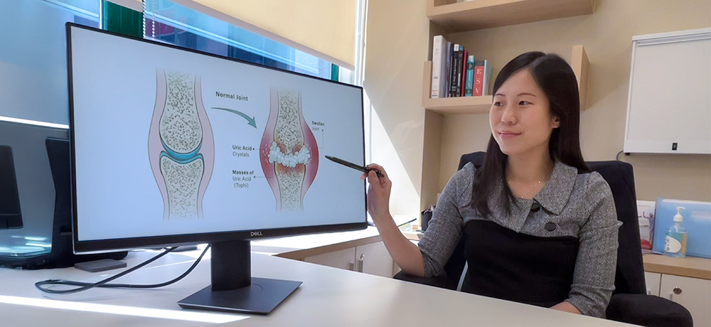 Dr Lydia Pok Say Lee explaining The Truth About Gout