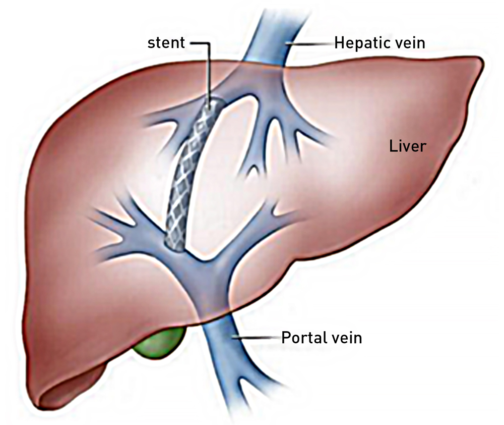 Liver