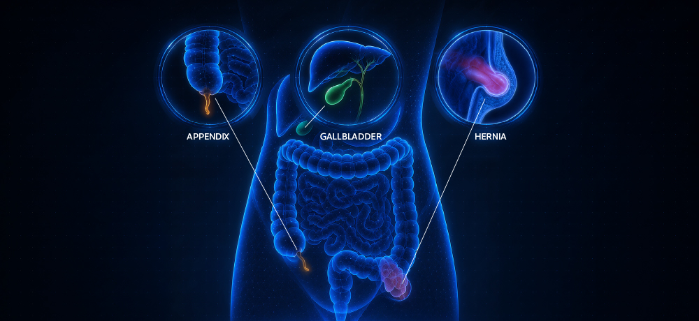 Hernia