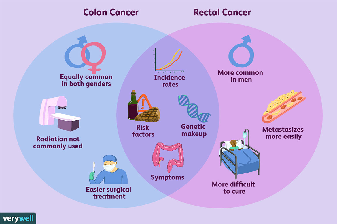 Colorectal Cancer Rates Rising in Young Adults