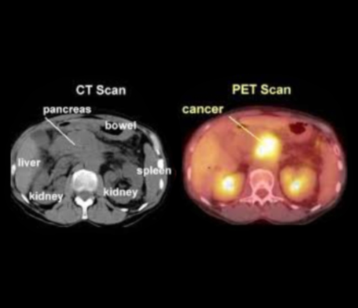 PET Scan Equipment, Department of Radiology