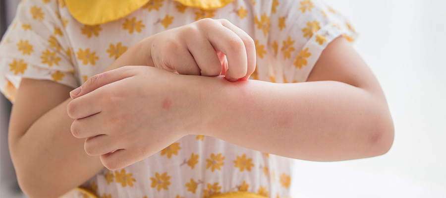 Rashes and Red Spot in Hand, Foot, and Mouth Disease