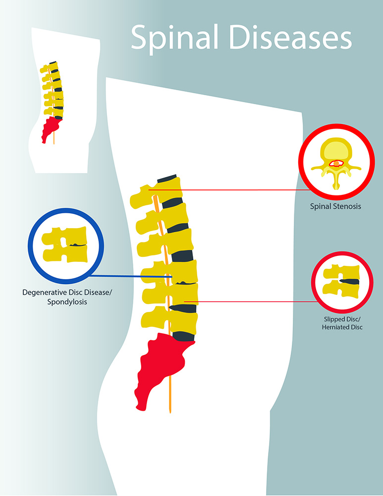 Spine Centre