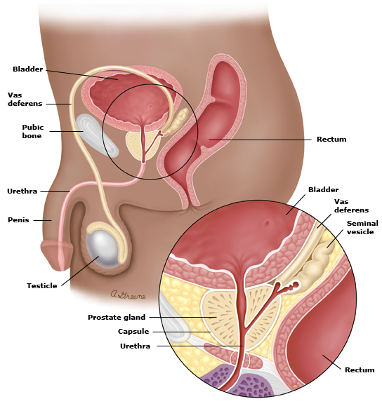 Prostate Cancer