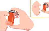 How to Use Your Metered Dose Inhaler (MDI)?