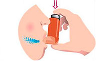 How to Use Your Metered Dose Inhaler (MDI)?