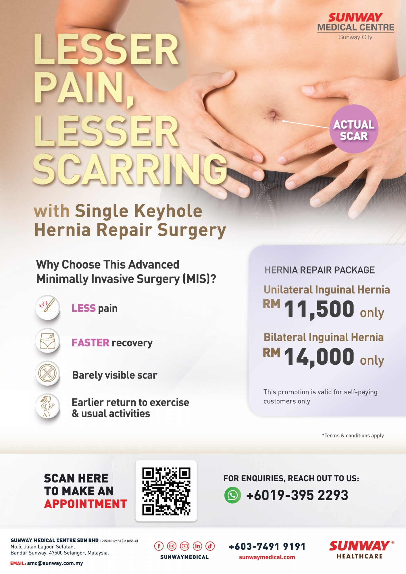 Hernia Repair Package I Sunway Medical Centre