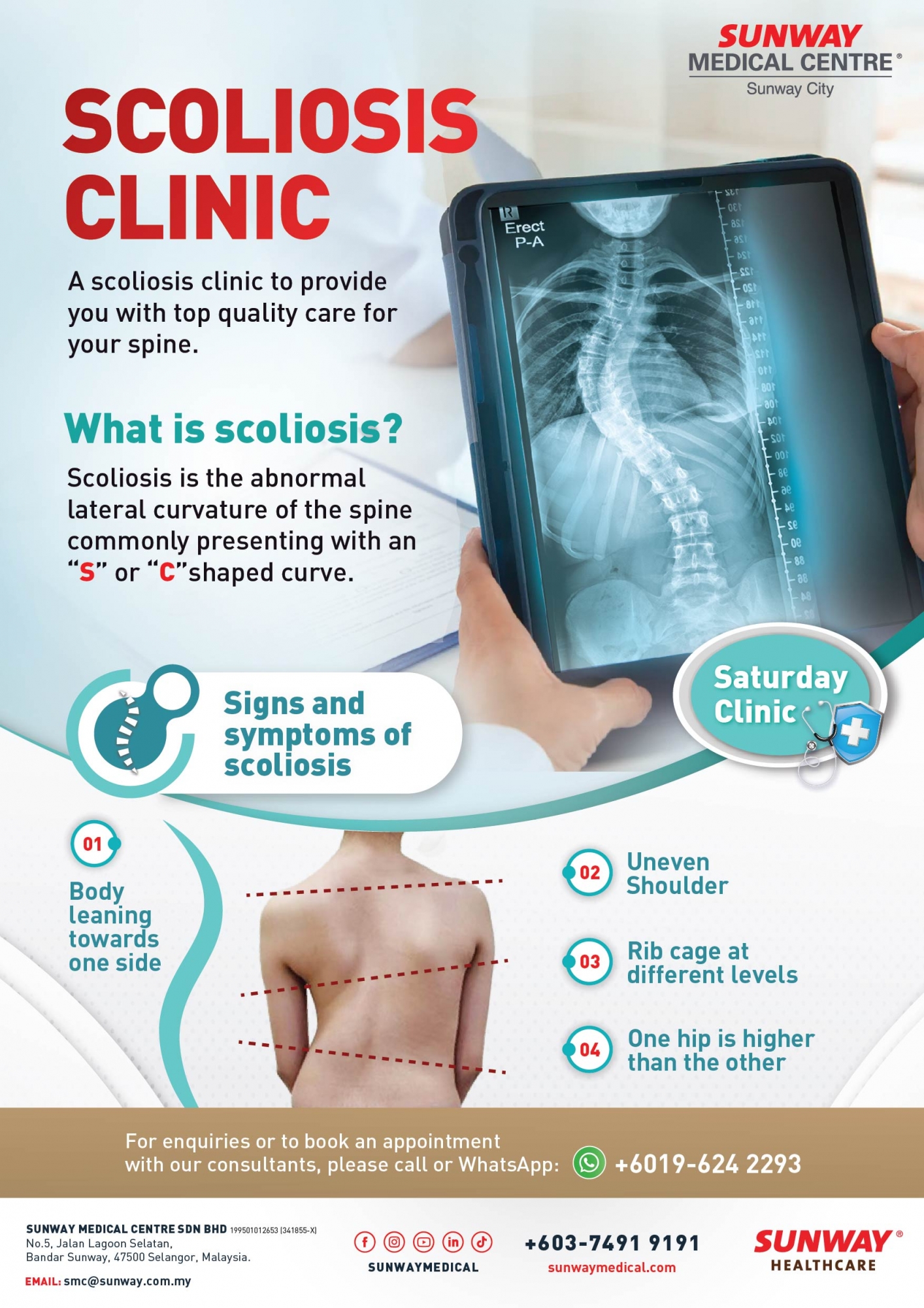 Scoliosis Clinic