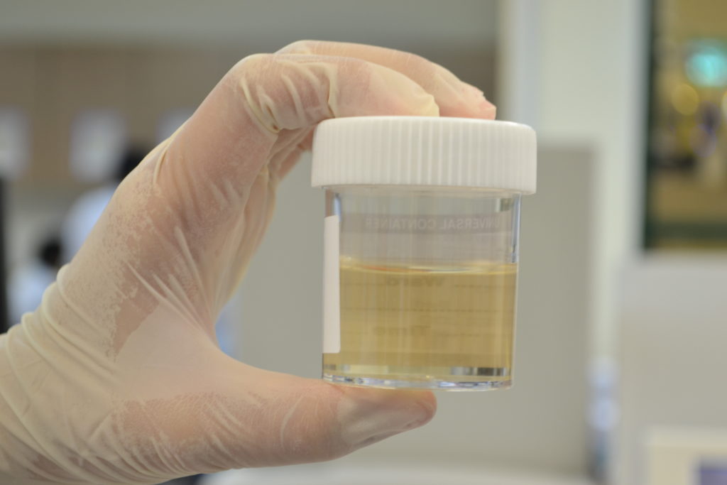 Test urine feme Urine FEME: